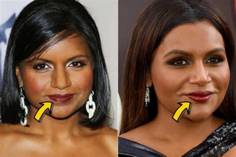 Mindy Kaling Plastic Surgery: Comparison of Before & After ...